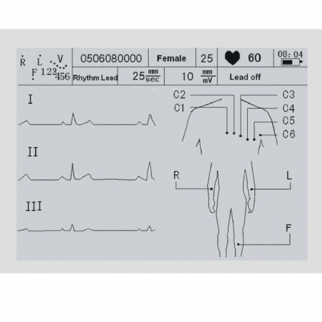 ECG CM1200B Electrocardiógrafo 12 canales