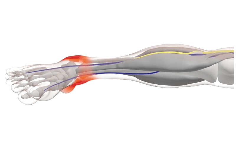 nervio-tibial-posterior